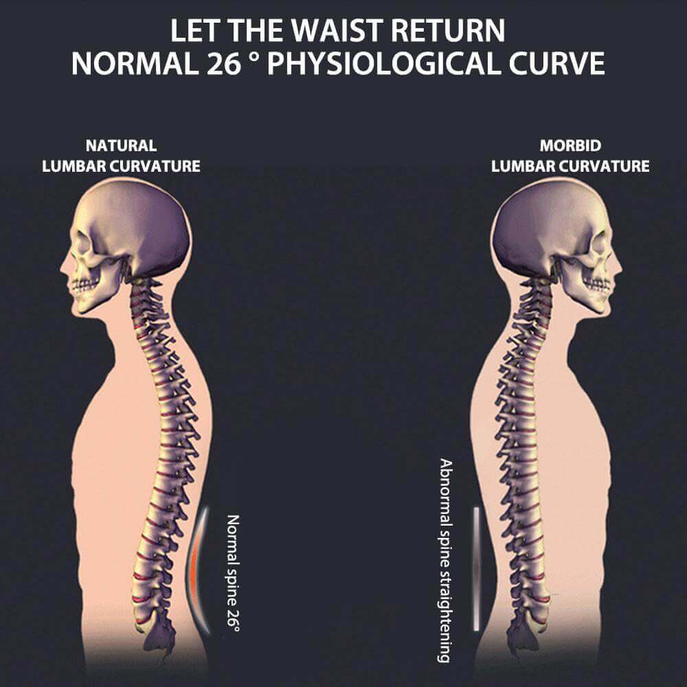 Illustration comparing natural and morbid lumbar curvature, highlighting the importance of maintaining a normal 26-degree physiological curve.